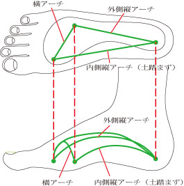 ���̃A�[�`���c�ނ�O�r��X�r�̌����ɂȂ�܂� ���� �}�b�T�[�W ���m���L��s