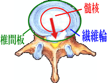 �ŊԔw���j�A�̐} ���̂�}�b�T�[�W�Œɂ݁A���т�����P ���m���L��s