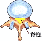 �ŊԔ̐} ���̂�}�b�T�[�W�Ńw���j�A�����P ���m���L��s